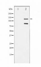 Polyclonal Rabbit anti-Human PARP1 Antibody (WB)