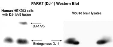 Polyclonal Rabbit anti-Human PARK7 / DJ-1 Antibody (C-Terminus, WB)