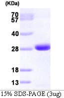 Human GRB2 Protein (Recombinant His)