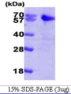 Human SMAD2 Protein (Recombinant His)