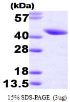 Human SERPINB5 / Maspin Protein (Recombinant His)