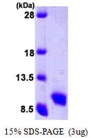 Human CCL5 / RANTES Protein (Recombinant)