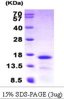 Human CCL28 / MEC Protein (Recombinant His)