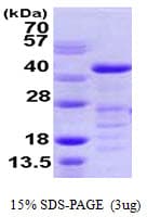 Human VASP Protein (Recombinant His)