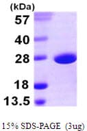 E. coli sodA Protein (Recombinant His)