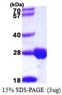 Human Thymidylate Kinase Protein (Recombinant His)