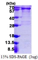 Human PDGFRA / PDGFR Alpha Protein (Recombinant His)