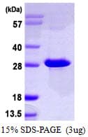 Human NT5M Protein (Recombinant His)