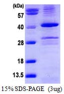 Human PPP1CA / PP1-Alpha Protein (Recombinant 6His, N-terminus)
