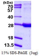 Human RBP1 / CRBP Protein (Recombinant His)