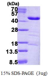Human LRPAP1 Protein (Recombinant His)