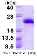 Human MANF / ARMET Protein (Recombinant His)