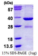 Human EYA2 Protein (Recombinant His)