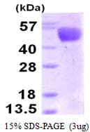 Influenza A Virus H3 Protein (Recombinant His)