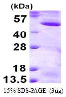 Human MAP2K2 / MKK2 / MEK2 Protein (Recombinant His)