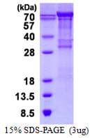 Human VCAM1 / CD106 Protein (Recombinant His)