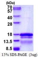 Human TCEAL7 Protein (Recombinant His)