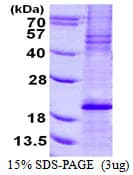 Human BCL2L11 / BIM Protein (Recombinant His)