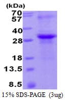 Human TIMP2 Protein (Recombinant His)