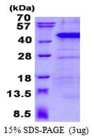 Human CARP / ANKRD1 Protein (Recombinant His)