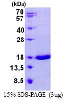 Mouse LGALS7 / Galectin 7 Protein (Recombinant His)