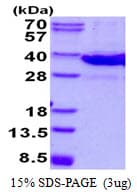 Mouse LGALS8 / Galectin 8 Protein (Recombinant His)