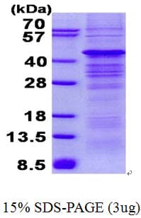 Human PRKAB1 / AMPK Beta 1 Protein (Recombinant His)