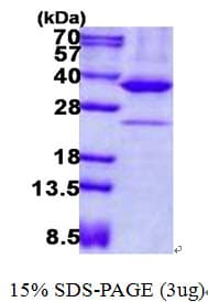 Human PRKAB2 / AMPK Beta 2 Protein (Recombinant His)