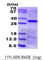 Human EPCAM Protein (Recombinant His)