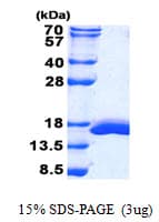 Mouse LGALS2 / Galectin 2 Protein (Recombinant His)