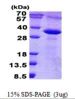 Human TROP2 / TACSTD2 Protein (Recombinant His)