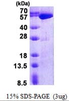 Human USP14 Protein (Recombinant His)