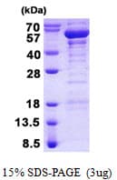 Human TANK Protein (Recombinant His)