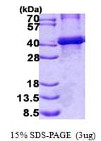 Human BGN / Biglycan Protein (Recombinant His)