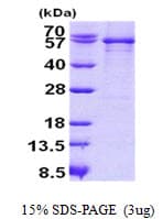 Human SERPING1 / C1 Inhibitor Protein (Recombinant His)