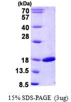 Human RBP2 / CRBPII Protein (Recombinant His)