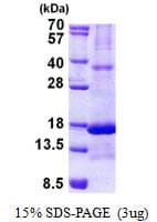 Human RARRES2 / Chemerin Protein (Recombinant His)