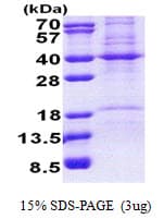 Human Prohibitin 2 / PHB2 Protein (Recombinant His)