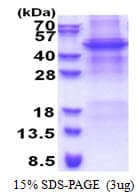Human APOBEC4 Protein (Recombinant His)