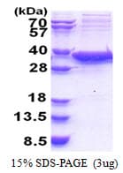 Human SIRT5 / Sirtuin 5 Protein (Recombinant His)