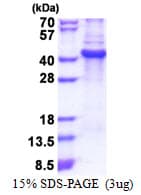 Human Lumican Protein (Recombinant His)