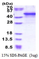 Human MMP10 Protein (Recombinant His)