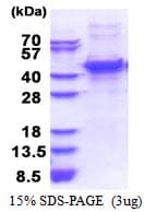 Human MMP13 Protein (Recombinant His)