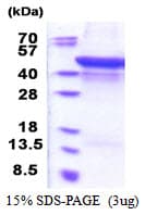 Human MMP1 Protein (Recombinant His)