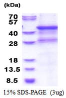 Human MMP8 Protein (Recombinant His)
