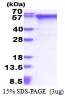 Human MMP2 Protein (Recombinant His)