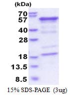 Human HPX / Hemopexin Protein (Recombinant His)