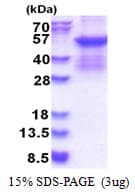 Human Antithrombin-III Protein (Recombinant His)