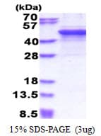 Human MMP3 Protein (Recombinant His)
