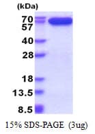 Human AIFM1 / AIF / PDCD8 Protein (Recombinant His)